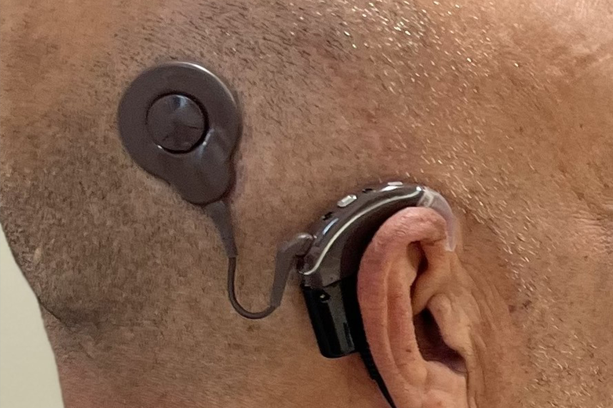 cochlear implant programing
