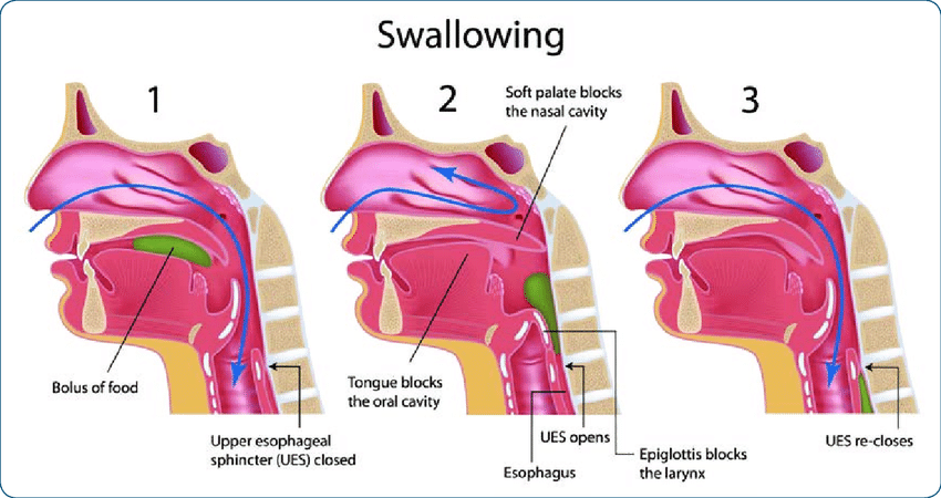 Adult Dysphagia Learn About Swallowing position1