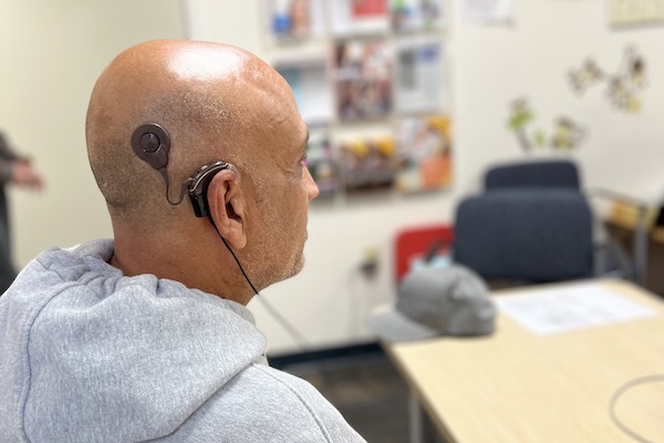 Cochlear implant activation