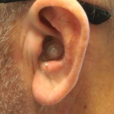 hearing aid and devices