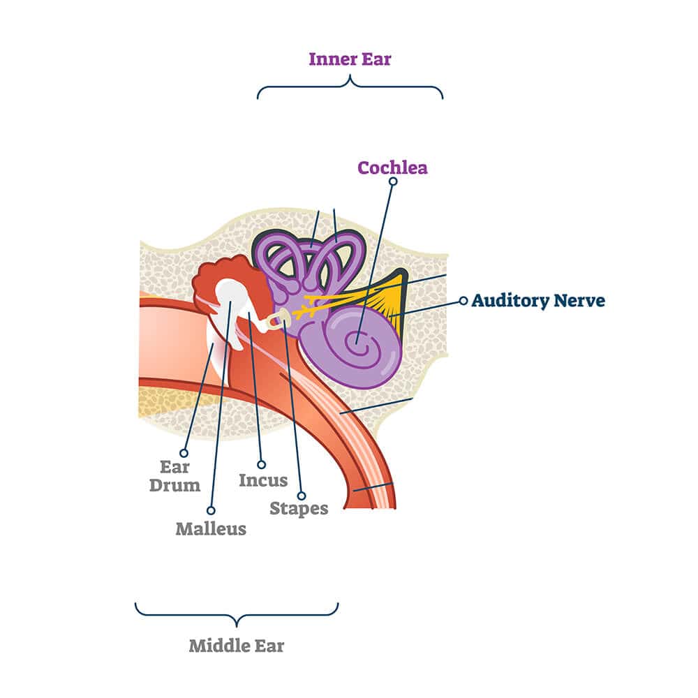 Sensorineural Hearing Loss 